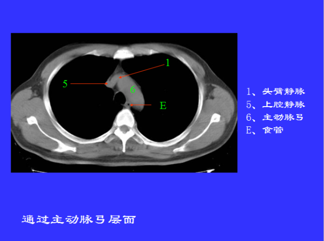 胸部CT阅读与诊断