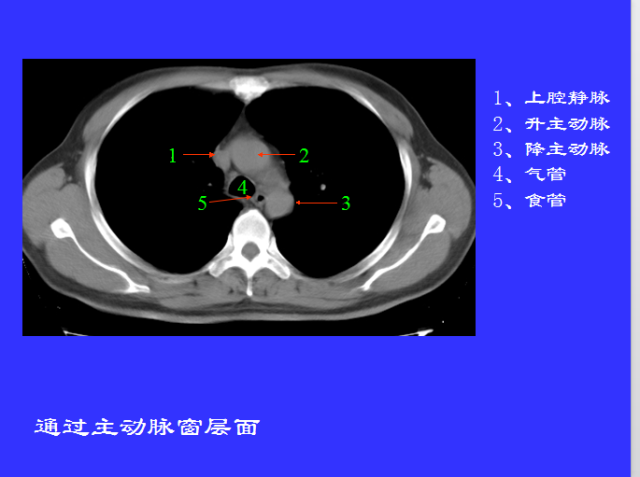 胸部CT阅读与诊断
