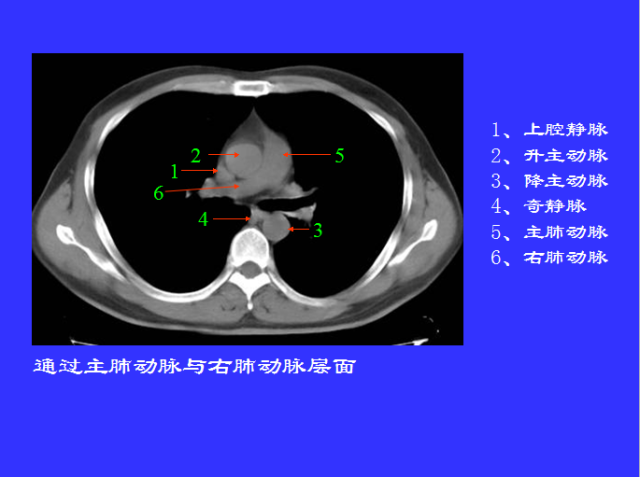 胸部CT阅读与诊断