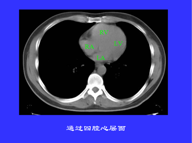 胸部CT阅读与诊断