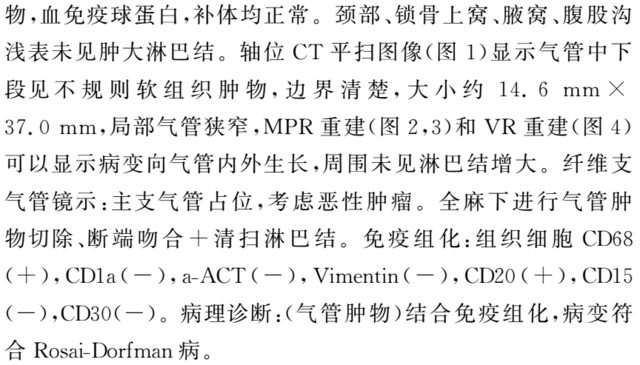 气管Rosa-iDorfman病