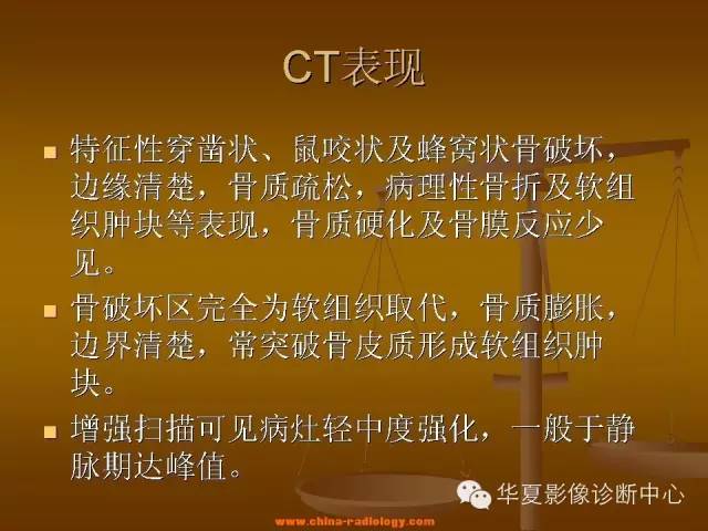 【病例学习】胸骨浆细胞骨髓瘤一例CT诊断与鉴别