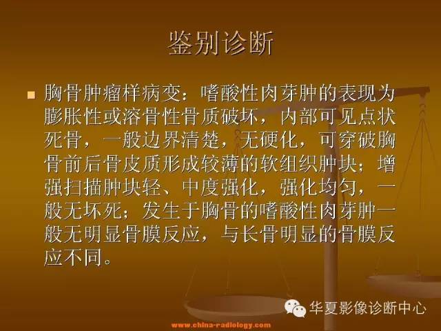 【病例学习】胸骨浆细胞骨髓瘤一例CT诊断与鉴别