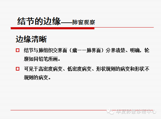 孤立性肺结节/肿块及相关CT征像判断的准则