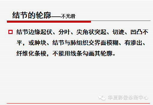 孤立性肺结节/肿块及相关CT征像判断的准则