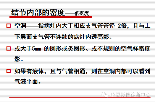 孤立性肺结节/肿块及相关CT征像判断的准则
