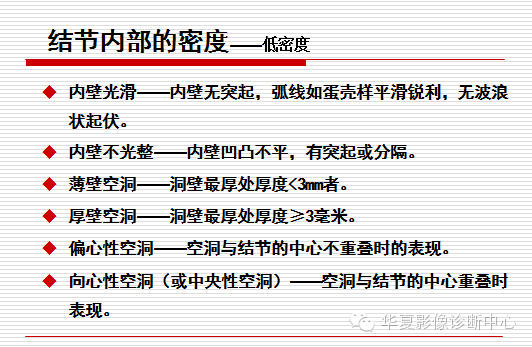 孤立性肺结节/肿块及相关CT征像判断的准则