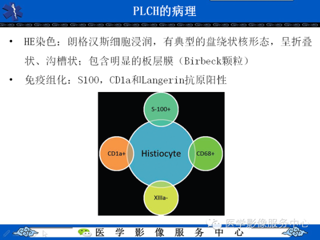 胸部组织细胞病变的影像学表现