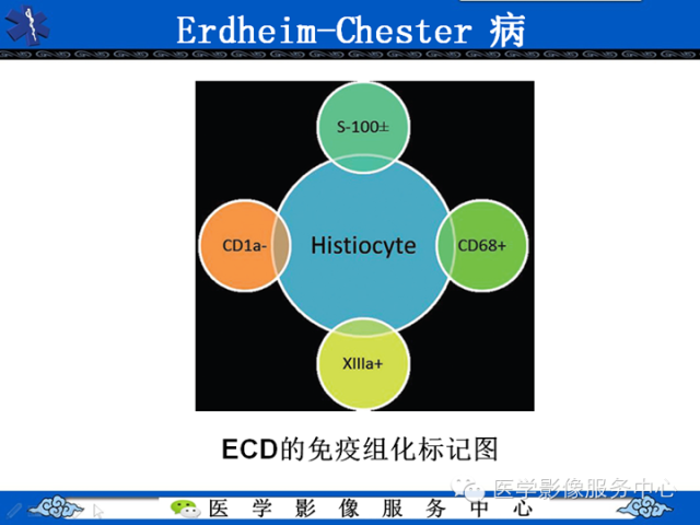 胸部组织细胞病变的影像学表现