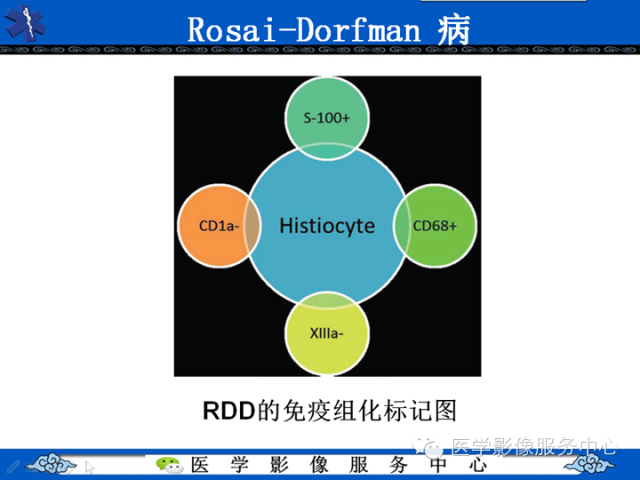 胸部组织细胞病变的影像学表现