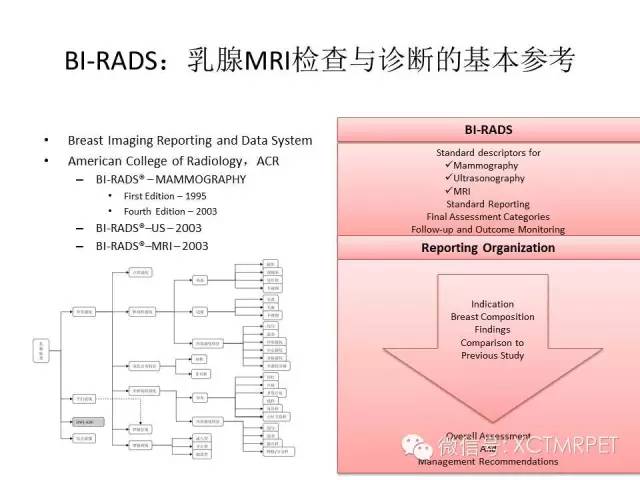 乳腺MRI：从检查到诊断