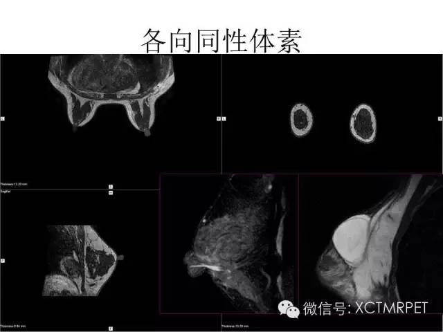 乳腺MRI：从检查到诊断
