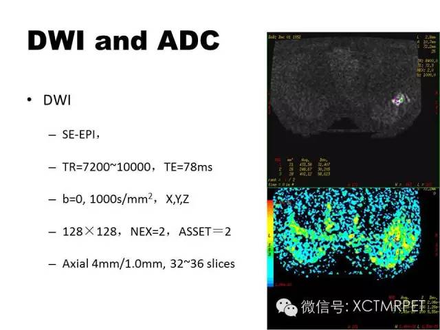 乳腺MRI：从检查到诊断