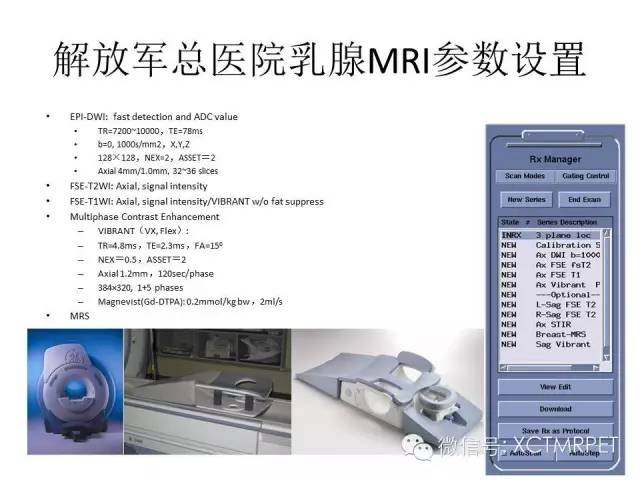 乳腺MRI：从检查到诊断