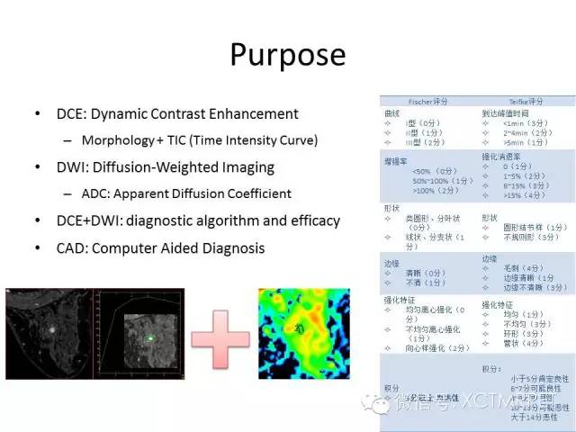 乳腺MRI：从检查到诊断