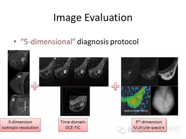 乳腺MRI：从检查到诊断
