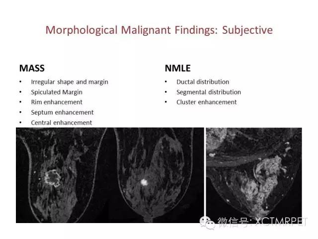 乳腺MRI：从检查到诊断