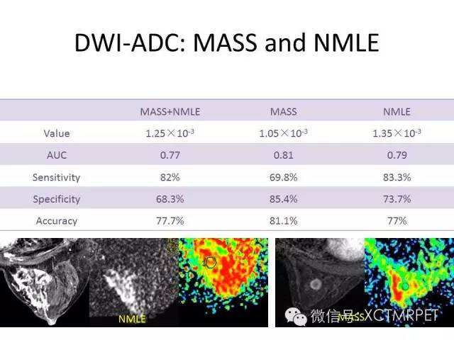乳腺MRI：从检查到诊断