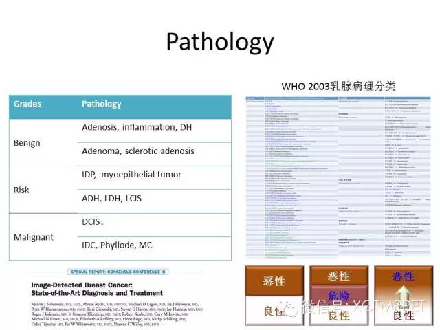 乳腺MRI：从检查到诊断
