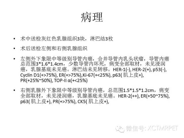 乳腺MRI：从检查到诊断