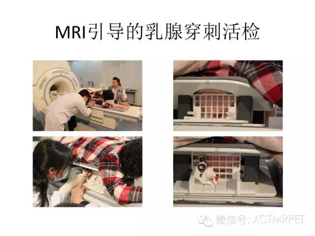 乳腺MRI：从检查到诊断