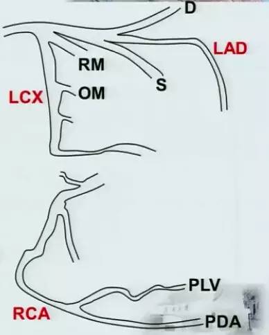 冠脉造影阅片要领 冠脉造影阅片要领