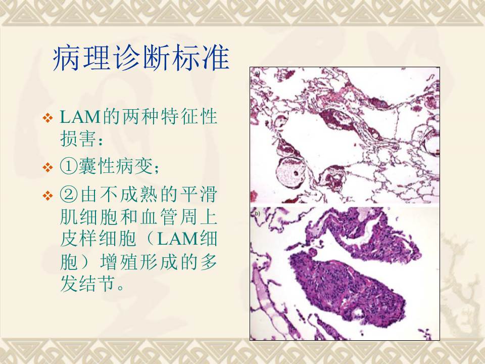 幻灯片14