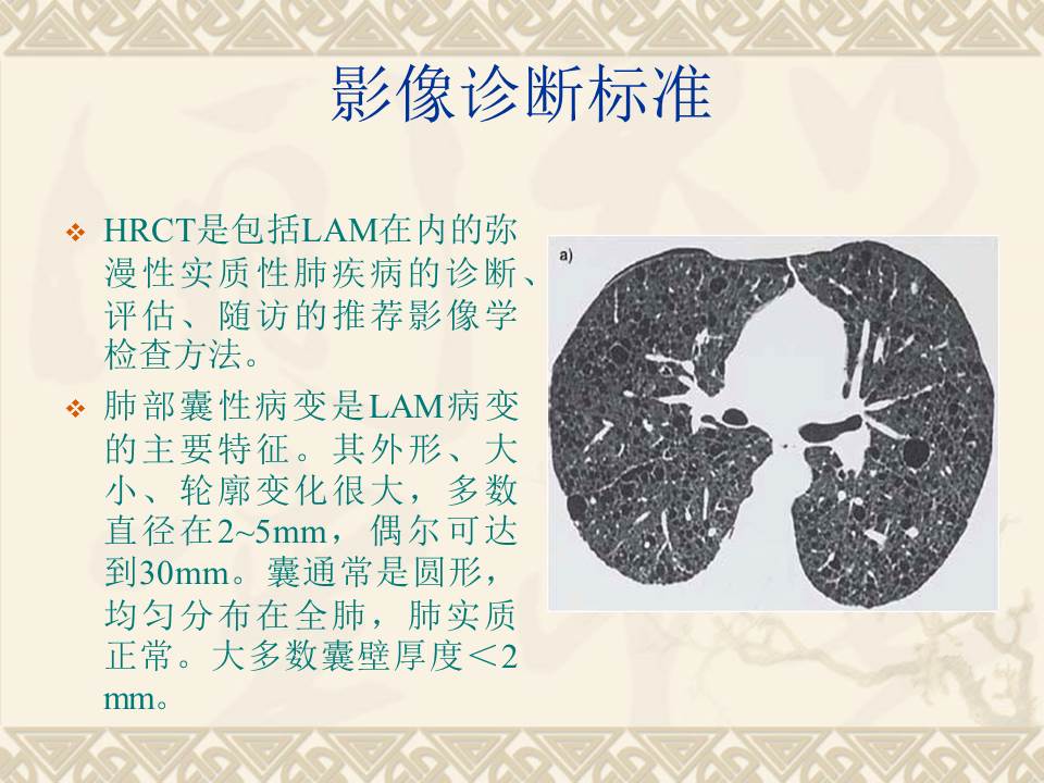幻灯片18