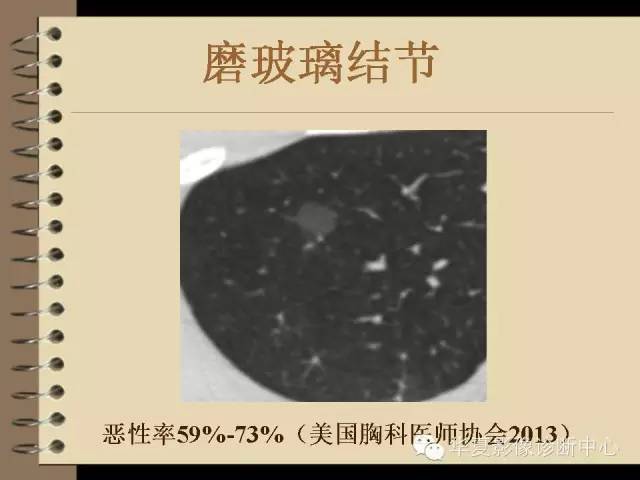 【PPT】早期肺癌影像诊断