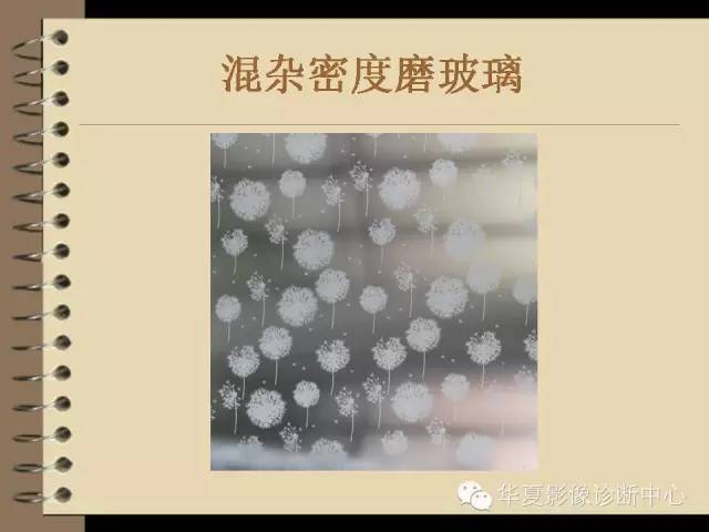 【PPT】早期肺癌影像诊断