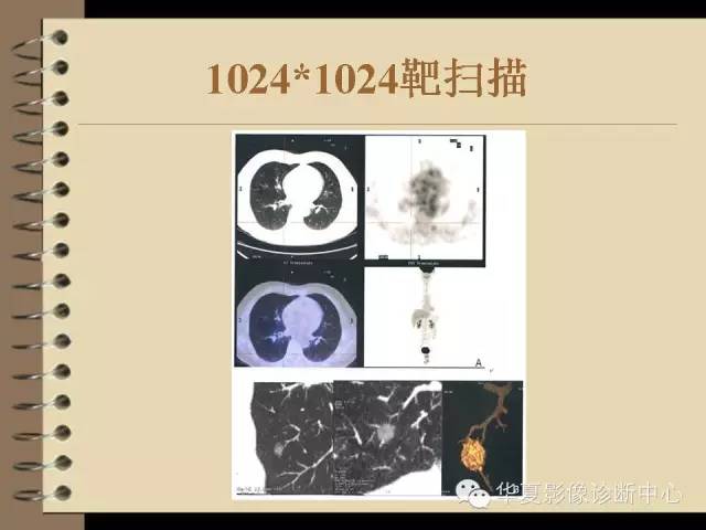 【PPT】早期肺癌影像诊断