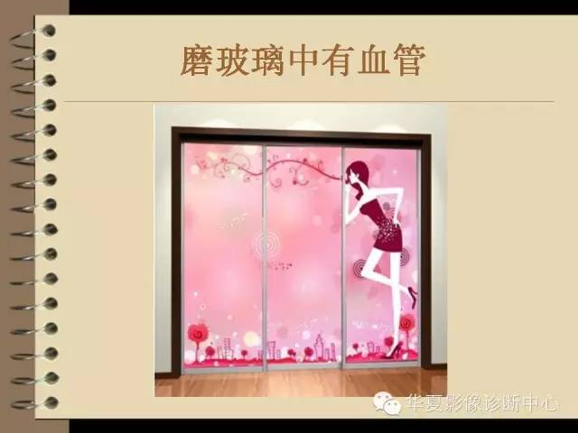 【PPT】早期肺癌影像诊断