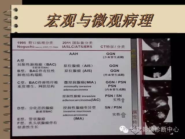 【PPT】早期肺癌影像诊断