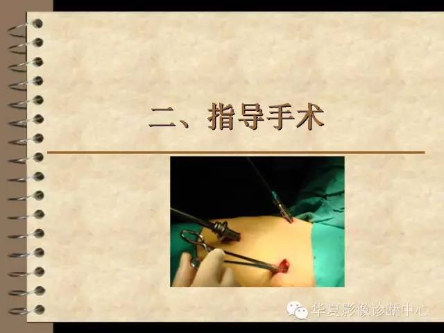 【PPT】早期肺癌影像诊断