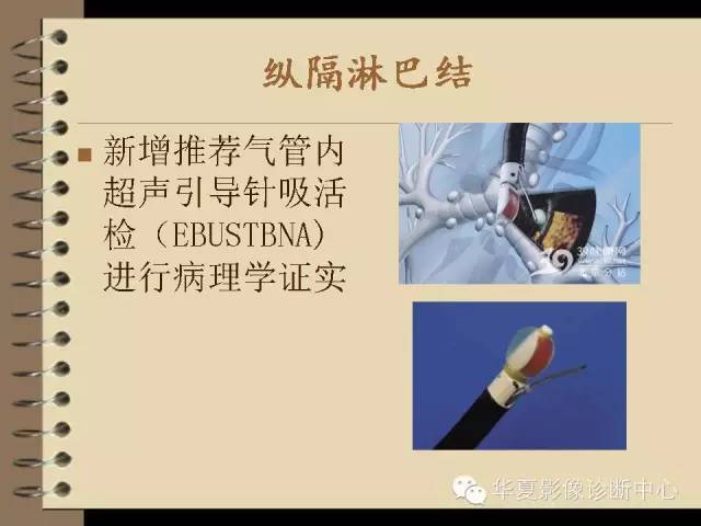 【PPT】早期肺癌影像诊断