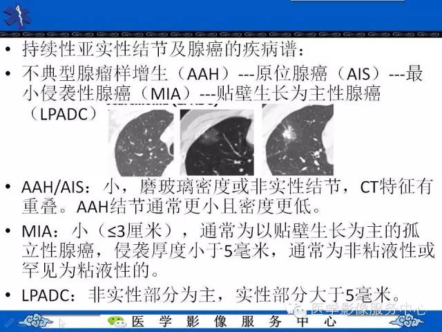 【PPT】亚实性肺结节—影像诊断医师和临床医师必知内容