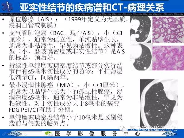 【PPT】亚实性肺结节—影像诊断医师和临床医师必知内容
