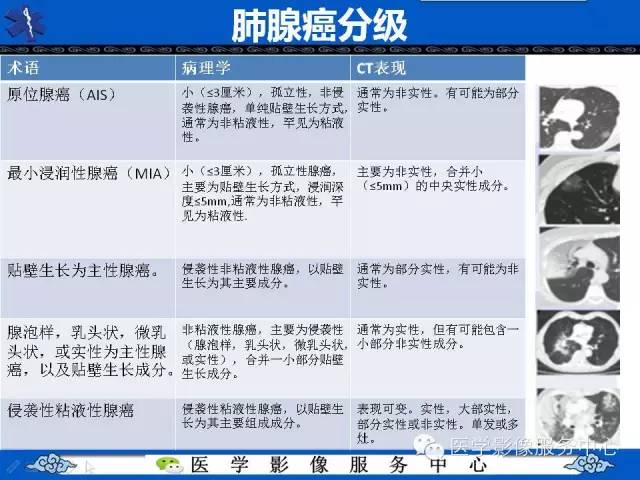 【PPT】亚实性肺结节—影像诊断医师和临床医师必知内容