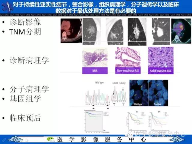 【PPT】亚实性肺结节—影像诊断医师和临床医师必知内容