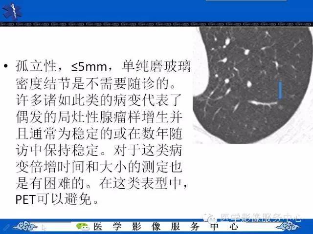 【PPT】亚实性肺结节—影像诊断医师和临床医师必知内容