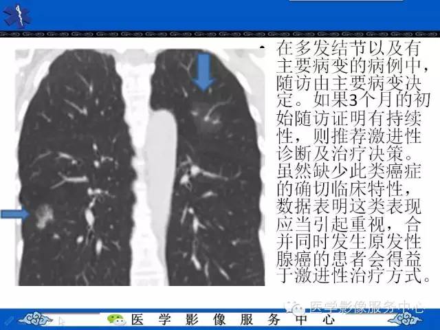 【PPT】亚实性肺结节—影像诊断医师和临床医师必知内容