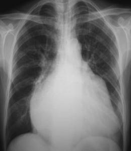 100张典型X线图片