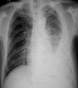 100张典型X线图片