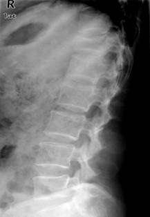 100张典型X线图片