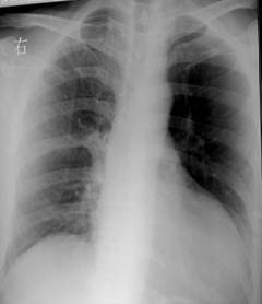 100张典型X线图片