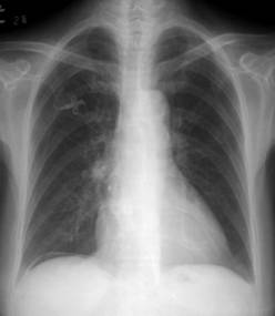 100张典型X线图片