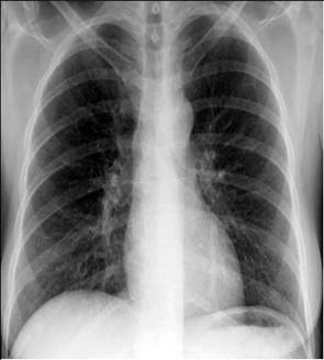100张典型X线图片
