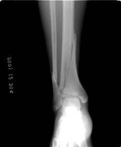 100张典型X线图片