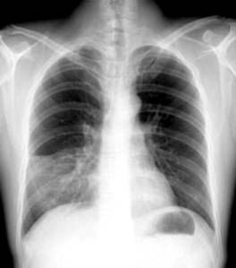 100张典型X线图片