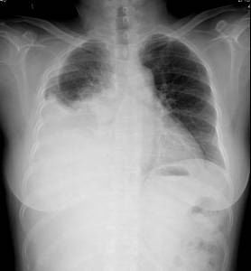 100张典型X线图片